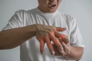 Hand Gouts - Chiropractic