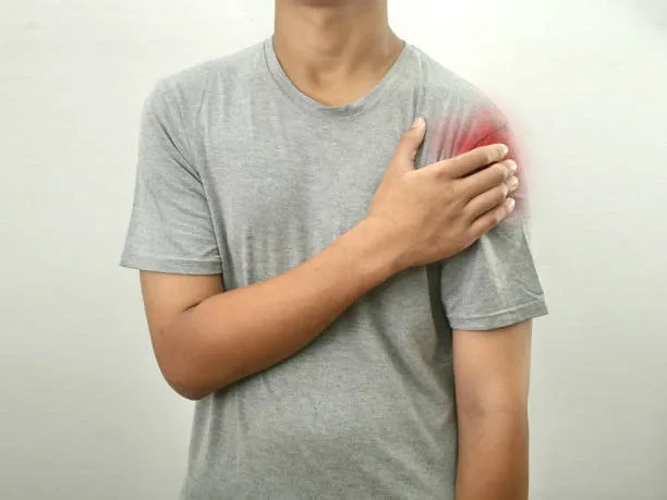 Shoulder Impingement Syndrome in Houston TX